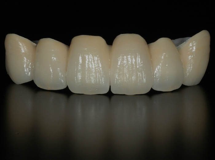 general coverage period for zirconia